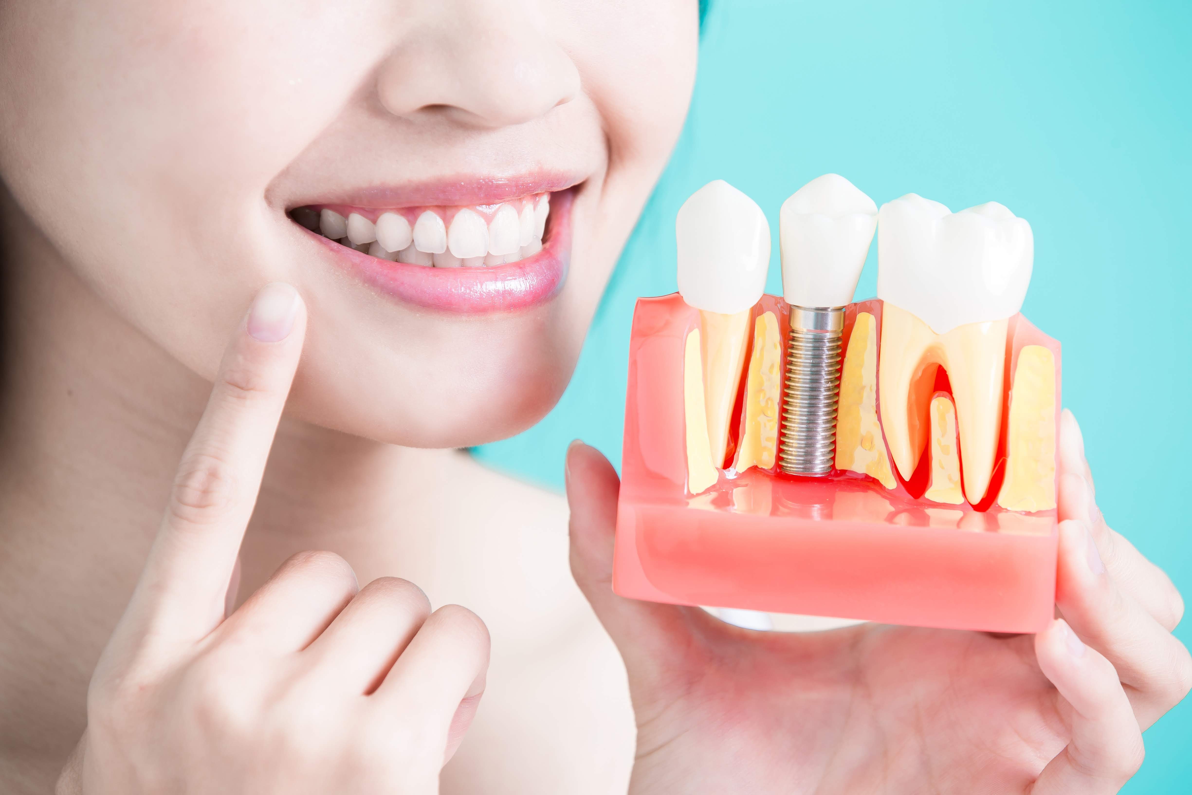 My Dentist PC: The Family Practice: Service Image-5 My Dentist PC: The Family Practice: Service Image-5